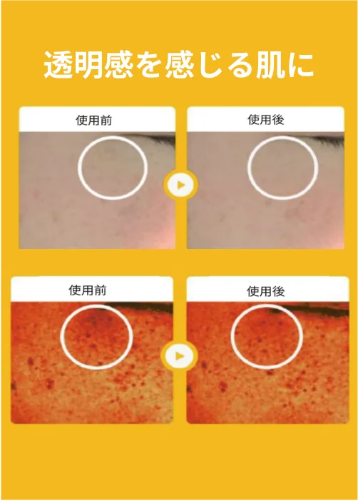 ANGEL LOOKAジュナムピュアビタミンC25%セラム肌画像