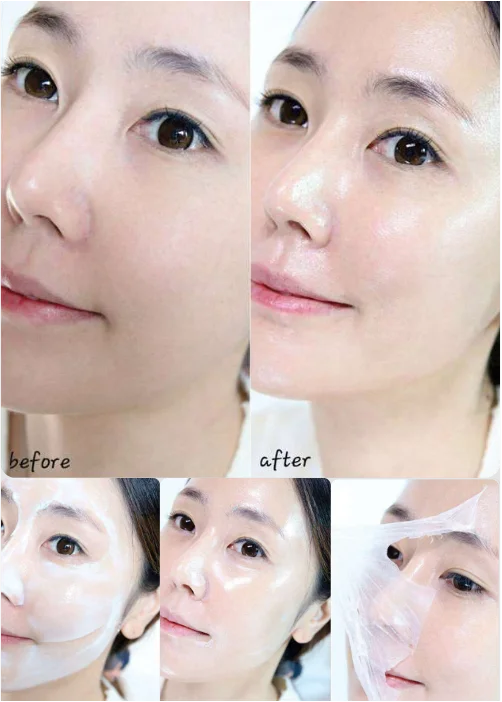 ANGEL LOOKAジュナム300ダルトンコラーゲンラッピング水光パック使用例